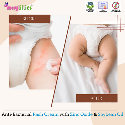 Soybean Oil & Calendula Diaper Rash Cream, 100g